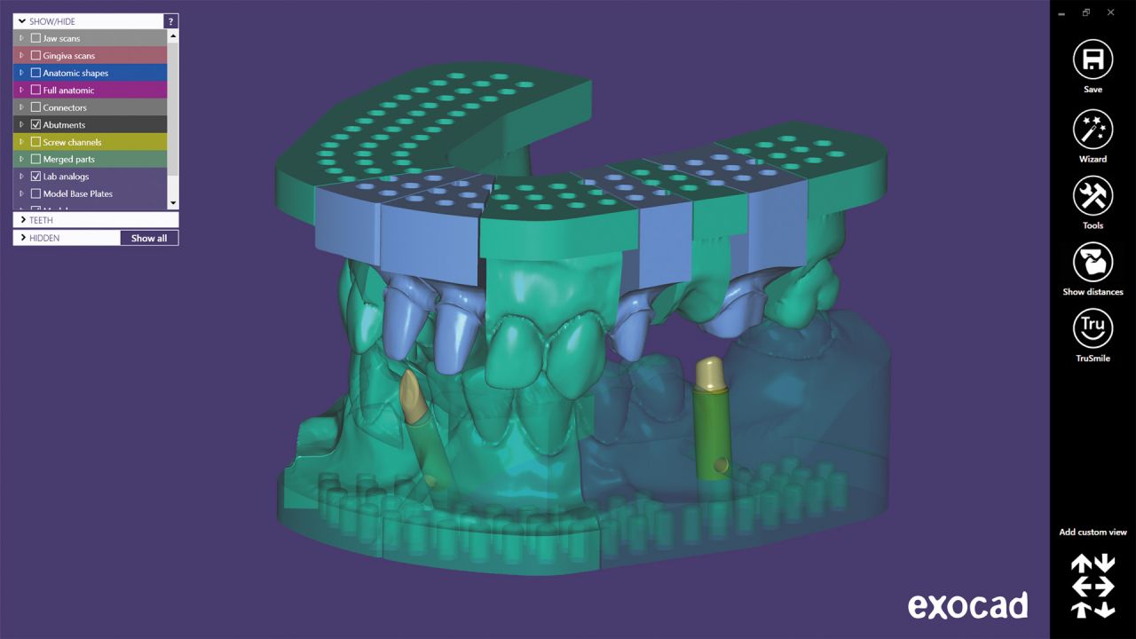 цифровая стоматология, cad cam