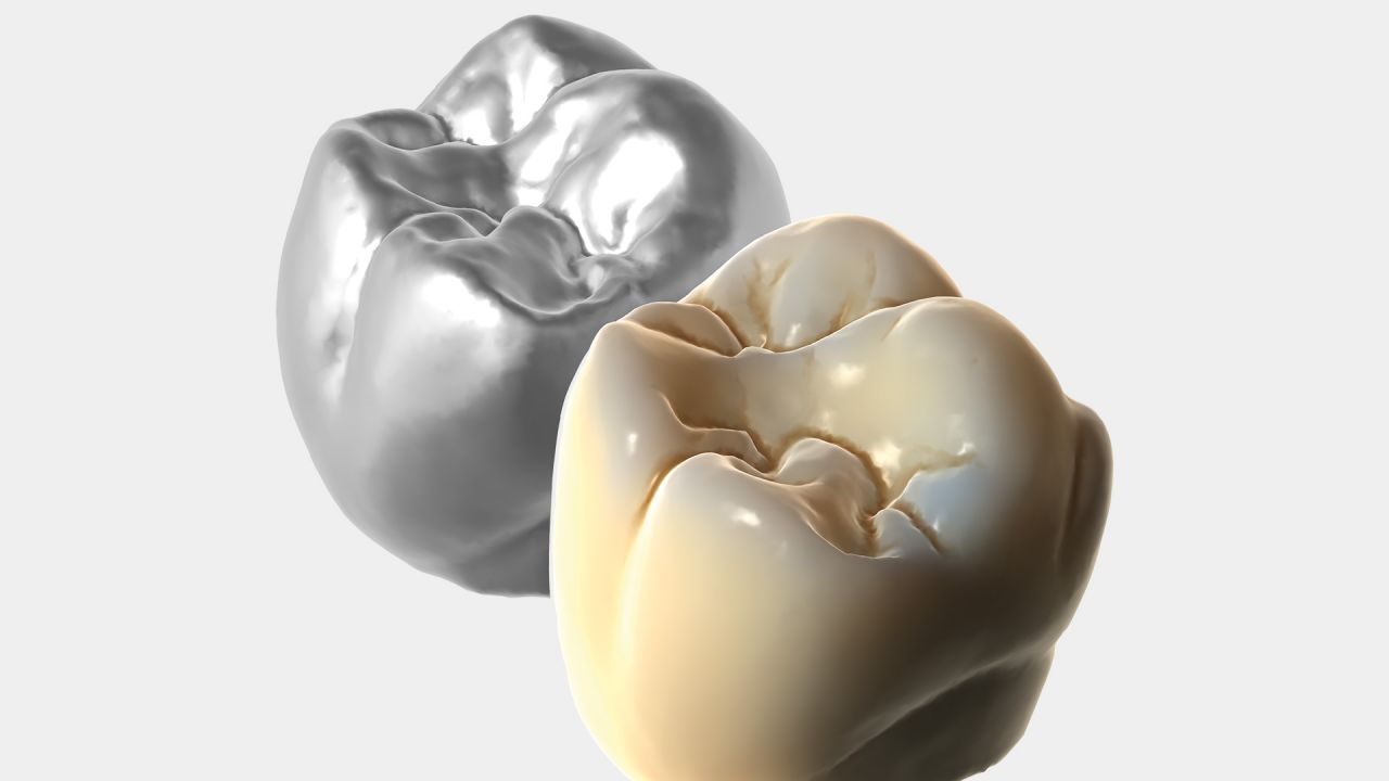 цифровая стоматология, cad cam