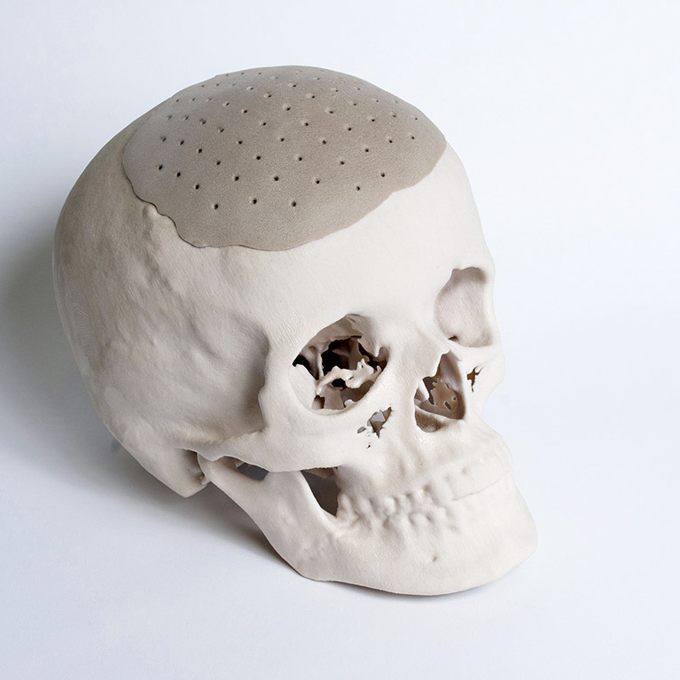 3D-печать: Исследования TUKE и ENBICORE