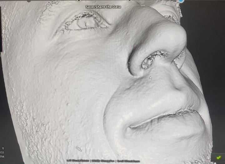 Сканирование в стоматологии